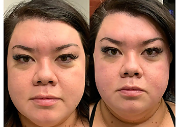 Gilbert Med Spa Raise The Bar Med Spa