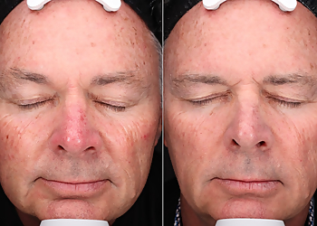 Akron Med Spa ReLux Medical Spa