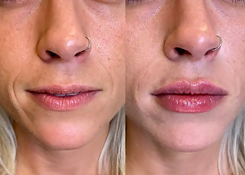 Akron Med Spa ReLux Medical Spa