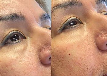 ReVive RX Med Spa - Kansas City, MO Med Spas - Treatment Image