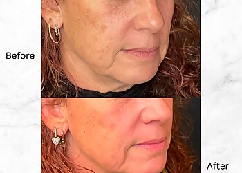 Long Beach Med Spa Reddy Aesthetics