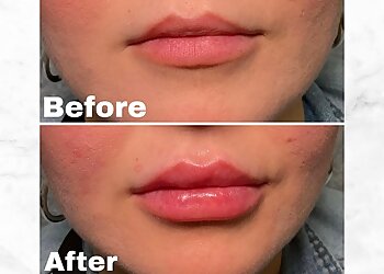 Long Beach Med Spa Reddy Aesthetics