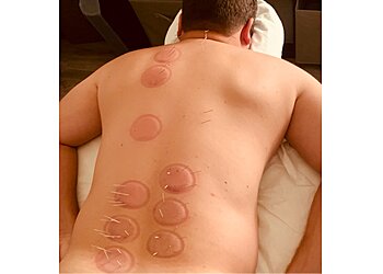 San Bernardino Acupuncture Redlands Family Acupuncture