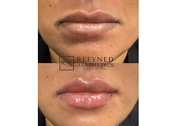 Fresno Med Spa Refyned Aesthetics Medical Spa