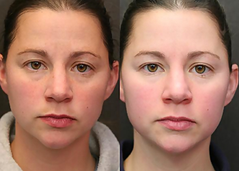 Pasadena Med Spa RejuvaYou Medical Spa