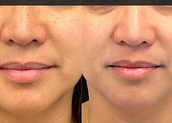 Fremont Med Spa Renew MD Wellness