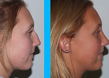 Fort Wayne Plastic Surgeon Robert Severinac, MD - INDIANA PLASTIC SURGERY CENTER