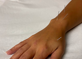 Rose City Acupuncture - Beaverton, OR Acupuncture - Medical Procedure Image