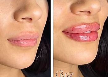 Irving Med Spa SN Beauty Med Spa