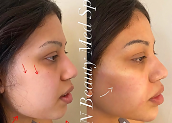 Irving Med Spa SN Beauty Med Spa