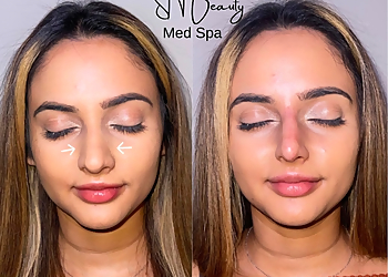 SN Beauty Med Spa Irving Med Spa image 1