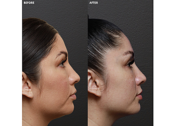 Anaheim Plastic Surgeon Saba Motakef, MD - MOTAKEF PLASTIC SURGERY + MED SPA