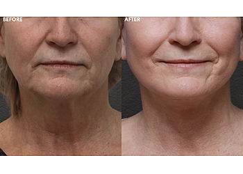 Anaheim Plastic Surgeon Saba Motakef, MD - MOTAKEF PLASTIC SURGERY + MED SPA