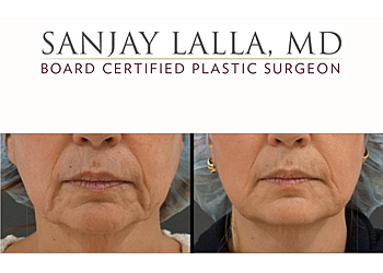 Sanjay Lalla, MD, FACS - Jersey City, NJ Plastic Surgeons - Healthcare Moments