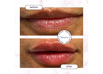 North Las Vegas Med Spa Seamless Aesthetics