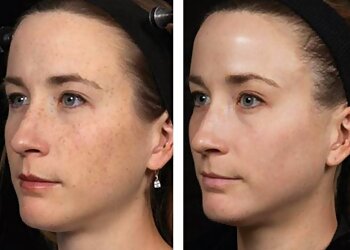 San Francisco Med Spa Serenity MedSpa