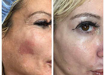 Yonkers Med Spa Simply Skin Laser Medispa