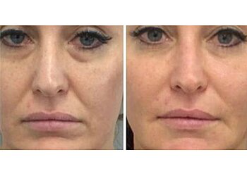 Des Moines Med Spa Skin Body Soul