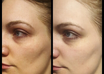 Des Moines Med Spa Skin Body Soul