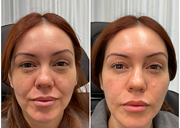SkinFX Medical Spa - Pasadena, CA Med Spas - Treatment Image