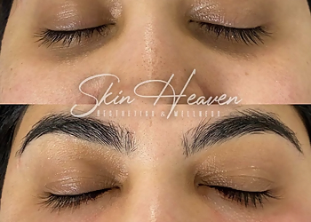 Anaheim Med Spa Skin Heaven Aesthetics and Wellness