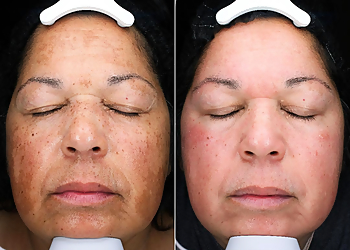 Chesapeake Med Spa Skin Renaissance Clinic