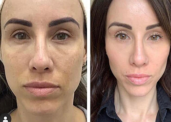 Skin Technology - Irving, TX Med Spas - Treatment Image