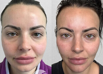 Fort Worth Med Spa Skinique Med Spa & Wellness