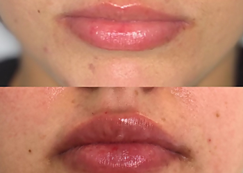 Memphis Med Spa Sneed Medispa