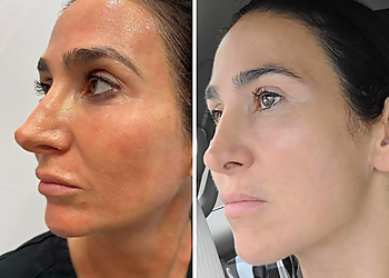 Huntington Beach Med Spa SoCal Lazer & Medi-Spa