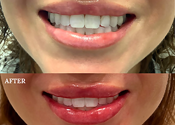 Huntington Beach Med Spa SoCal Lazer & Medi-Spa