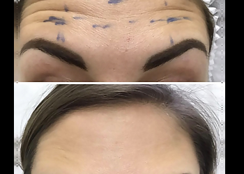 Baltimore Med Spa Sollay Cosmetic Medical & Laser Center