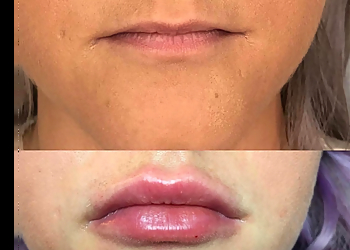 Baltimore Med Spa Sollay Cosmetic Medical & Laser Center