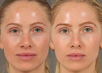 Orange Med Spa Spa Aesthetica Medical Spa & Wellness Center