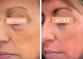 Riverside Med Spa Sublime MD