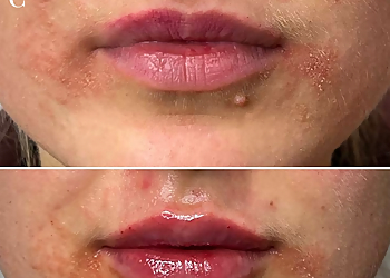 Burbank Med Spa The Beauty Clinic