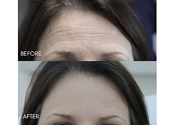 Fort Lauderdale Med Spa The Beauty Clinic