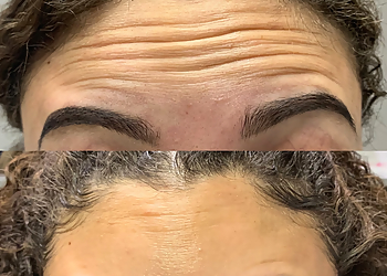 Fort Wayne Med Spa The Downtown Wellness Spa