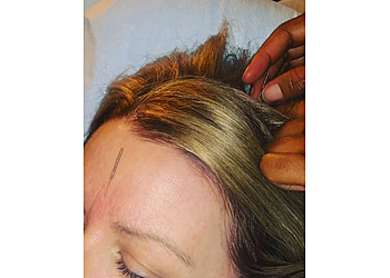 Naperville Acupuncture The Emperor’s Medicine