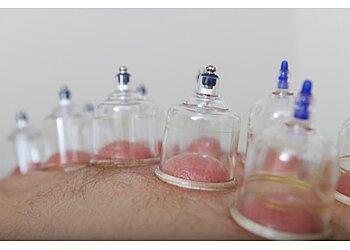 Reno Acupuncture The Finley Center