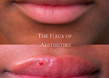 The Haus of Aesthetiks Medspa & Wellness - Grand Prairie, TX Med Spas - Before and After Image