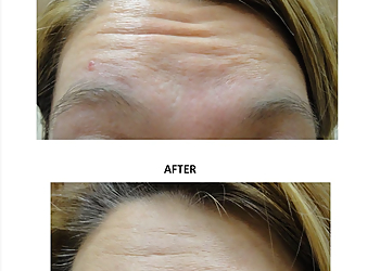 Fort Wayne Med Spa The Medical Spa