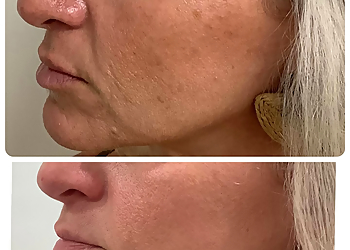 Norfolk Med Spa The Spa & Laser Center