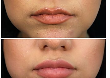 Portland Med Spa Thrive Aesthetic & Wellness