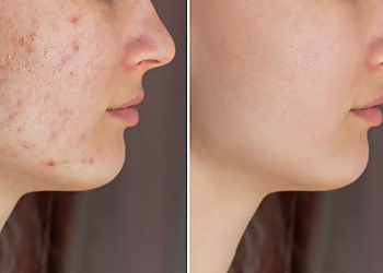 Madison Med Spa Total Body Laser & Med Spa