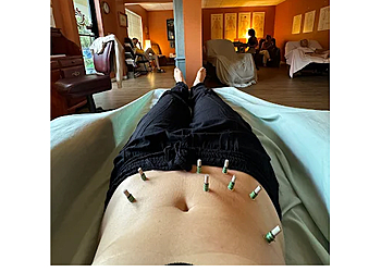 Port St Lucie Acupuncture Treasure Coast Community Acupuncture