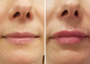 Jersey City Med Spa Wonderlash Studio