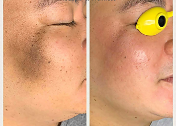 Baltimore Med Spa Zare MedSpa and Wellness